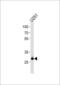 CCR4-NOT Transcription Complex Subunit 8 antibody, GTX81874, GeneTex, Western Blot image 