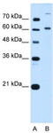 BMP2 Inducible Kinase antibody, TA344136, Origene, Western Blot image 