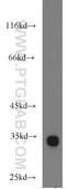 Dynein Axonemal Light Intermediate Chain 1 antibody, 17601-1-AP, Proteintech Group, Western Blot image 