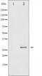 Heat Shock Protein Family B (Small) Member 1 antibody, abx010947, Abbexa, Western Blot image 