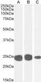 Chromobox 5 antibody, LS-B2394, Lifespan Biosciences, Western Blot image 