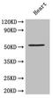 Matrix Metallopeptidase 10 antibody, LS-C285668, Lifespan Biosciences, Western Blot image 