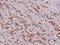 Histone Deacetylase 8 antibody, A01843S39, Boster Biological Technology, Immunohistochemistry paraffin image 