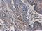 Interleukin 3 Receptor Subunit Alpha antibody, NBP2-16953, Novus Biologicals, Immunohistochemistry frozen image 