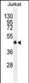 Olfactory Receptor Family 4 Subfamily N Member 4 antibody, PA5-48209, Invitrogen Antibodies, Western Blot image 