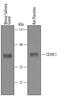 Ectonucleoside Triphosphate Diphosphohydrolase 2 antibody, PA5-47777, Invitrogen Antibodies, Western Blot image 