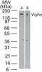 High Density Lipoprotein Binding Protein antibody, PA5-23310, Invitrogen Antibodies, Western Blot image 