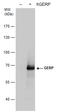 Tripartite Motif Containing 8 antibody, GTX119312, GeneTex, Western Blot image 
