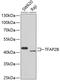 Transcription Factor AP-2 Beta antibody, GTX64592, GeneTex, Western Blot image 