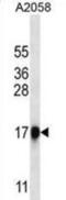 Chymotrypsin Like Elastase 1 antibody, abx029780, Abbexa, Western Blot image 