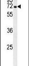 Glucosamine (UDP-N-Acetyl)-2-Epimerase/N-Acetylmannosamine Kinase antibody, PA5-25238, Invitrogen Antibodies, Western Blot image 