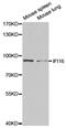 Interferon Gamma Inducible Protein 16 antibody, PA5-76462, Invitrogen Antibodies, Western Blot image 