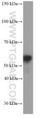 Peripherin antibody, 66317-1-Ig, Proteintech Group, Western Blot image 