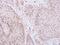 General Transcription Factor IIE Subunit 2 antibody, NBP1-32717, Novus Biologicals, Immunohistochemistry paraffin image 
