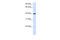 Glutamic-Oxaloacetic Transaminase 2 antibody, 25-873, ProSci, Enzyme Linked Immunosorbent Assay image 