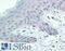 Tyrosinase antibody, LS-B15796, Lifespan Biosciences, Immunohistochemistry paraffin image 