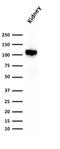 Cadherin 16 antibody, GTX34583, GeneTex, Western Blot image 
