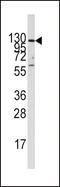 Insulin Degrading Enzyme antibody, MBS9212110, MyBioSource, Western Blot image 
