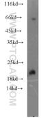 Potassium Voltage-Gated Channel Subfamily E Regulatory Subunit 1 antibody, 15150-1-AP, Proteintech Group, Western Blot image 