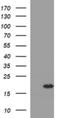 Synuclein Alpha antibody, NBP2-45892, Novus Biologicals, Western Blot image 