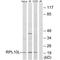 Ribosomal Protein L10 Like antibody, A15707, Boster Biological Technology, Western Blot image 