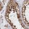 Katanin Catalytic Subunit A1 antibody, NBP1-89491, Novus Biologicals, Immunohistochemistry paraffin image 