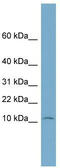 NOP10 Ribonucleoprotein antibody, TA344845, Origene, Western Blot image 