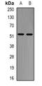 Galactosidase Alpha antibody, orb340773, Biorbyt, Western Blot image 