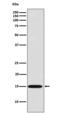 Galectin 7B antibody, M12693-1, Boster Biological Technology, Western Blot image 