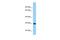 Ankyrin Repeat And SOCS Box Containing 11 antibody, PA5-69795, Invitrogen Antibodies, Western Blot image 