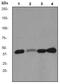 Cyclin Dependent Kinase 9 antibody, ab76320, Abcam, Western Blot image 