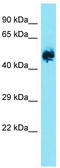 Eukaryotic Translation Initiation Factor 2B Subunit Gamma antibody, TA331249, Origene, Western Blot image 