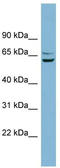 Basic, Immunoglobulin-Like Variable Motif Containing antibody, TA344974, Origene, Western Blot image 