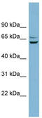 Basic, Immunoglobulin-Like Variable Motif Containing antibody, TA344974, Origene, Western Blot image 