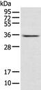 Acyl-CoA Binding Domain Containing 4 antibody, PA5-51189, Invitrogen Antibodies, Western Blot image 