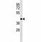 Oligodendrocyte Transcription Factor 2 antibody, F46745-0.4ML, NSJ Bioreagents, Western Blot image 