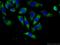 ATP-binding cassette sub-family F member 1 antibody, 13950-1-AP, Proteintech Group, Immunofluorescence image 