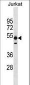 Thymopoietin antibody, LS-C157230, Lifespan Biosciences, Western Blot image 