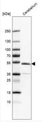 Zinc Finger Protein 692 antibody, NBP2-37973, Novus Biologicals, Western Blot image 