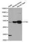 Cathepsin D antibody, LS-C331569, Lifespan Biosciences, Western Blot image 