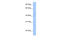 Lipoyltransferase 1, mitochondrial antibody, 30-449, ProSci, Western Blot image 