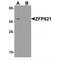 Zinc Finger Protein 821 antibody, MBS153559, MyBioSource, Western Blot image 