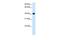 Alcohol Dehydrogenase 4 (Class II), Pi Polypeptide antibody, GTX16238, GeneTex, Western Blot image 