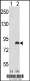 G Protein-Coupled Receptor Kinase 3 antibody, 63-777, ProSci, Western Blot image 
