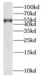 Akt antibody, FNab10227, FineTest, Western Blot image 