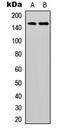 Erb-B2 Receptor Tyrosine Kinase 3 antibody, GTX32388, GeneTex, Western Blot image 