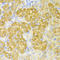 Cystathionine-Beta-Synthase antibody, LS-C331462, Lifespan Biosciences, Immunohistochemistry paraffin image 