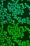 Insulin Like Growth Factor 2 MRNA Binding Protein 3 antibody, GTX32680, GeneTex, Immunofluorescence image 
