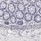 Tectonin Beta-Propeller Repeat Containing 2 antibody, HPA000658, Atlas Antibodies, Immunohistochemistry paraffin image 