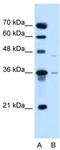 Solute Carrier Family 17 Member 3 antibody, TA346434, Origene, Western Blot image 